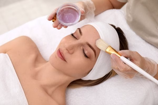 peeling químico profesional